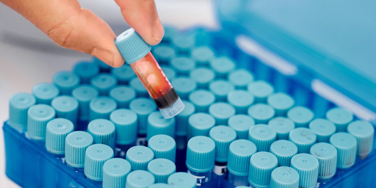 get it sent off immediately. Shot of a dentist inserting a blood sample into a tray